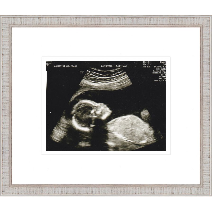 Rustic White Sonogram Frame with Double Mats