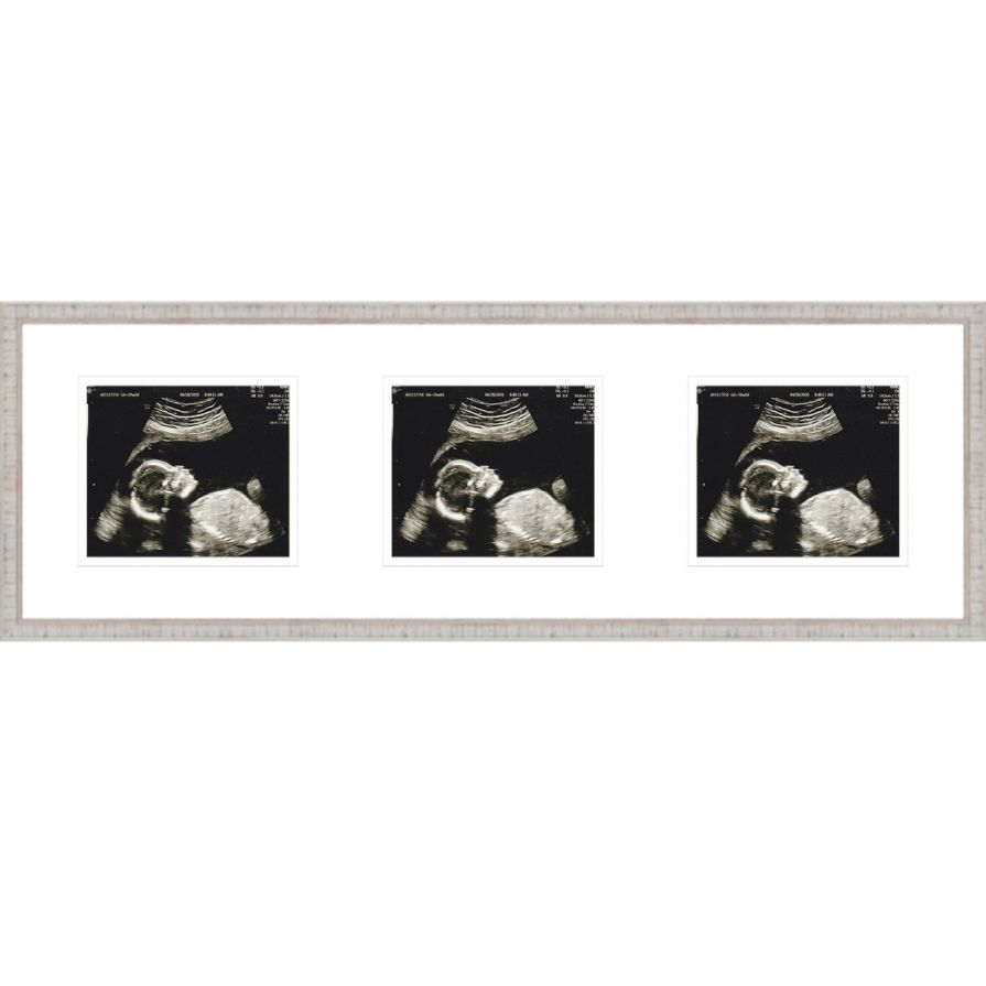 Rustic White Sonogram Frame with Double Mats for 3 Images