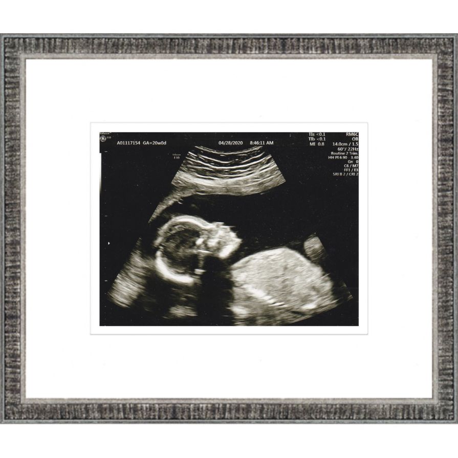 Rustic Silver Sonogram Frame with Double Mats