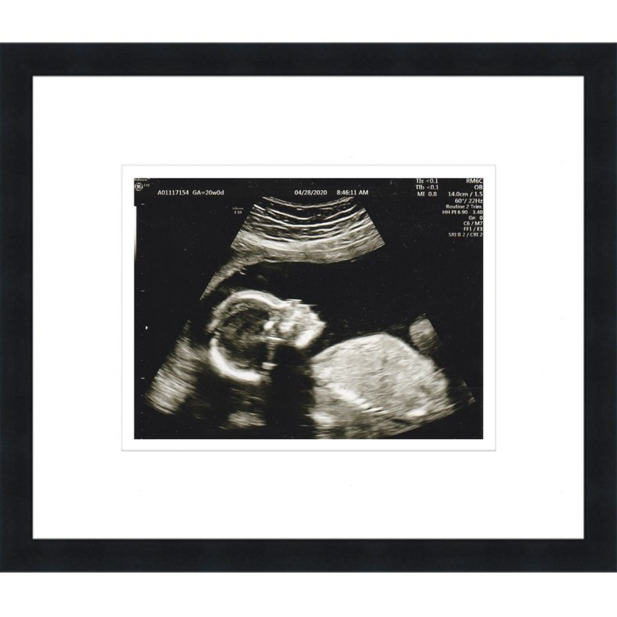 Black Sonogram Frame with Double Mats