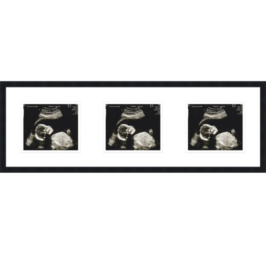 Black Sonogram Frame with Double Mats for 3 Images