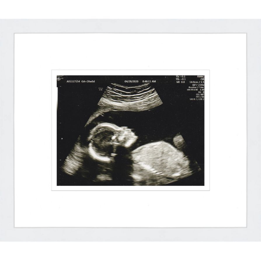 White Sonogram Frame with Double Mats