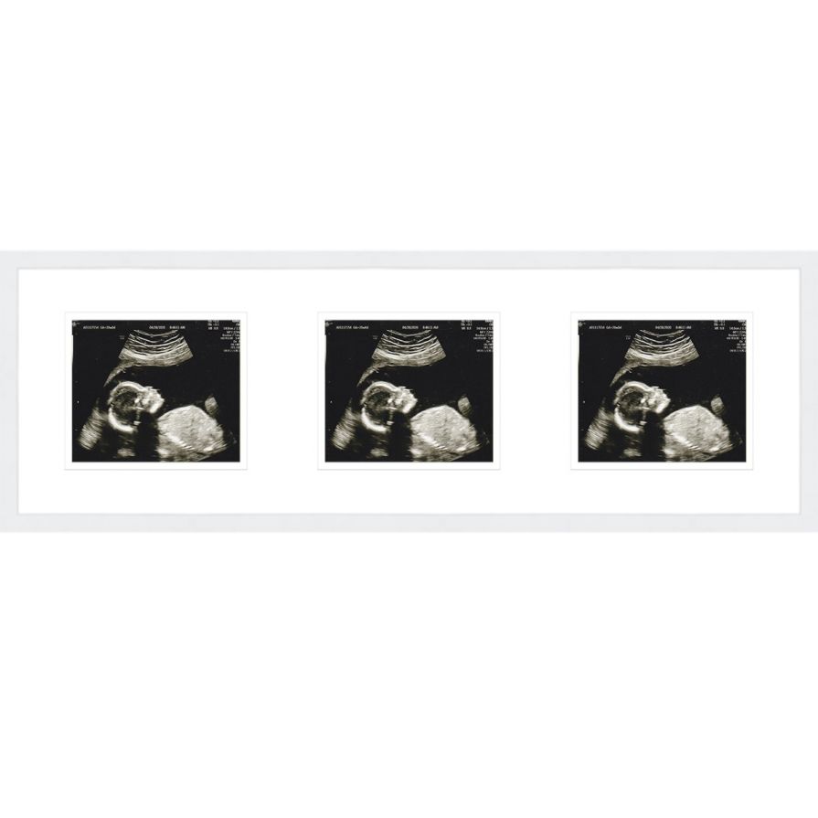 White Sonogram Frame with Double Mats for 3 Images