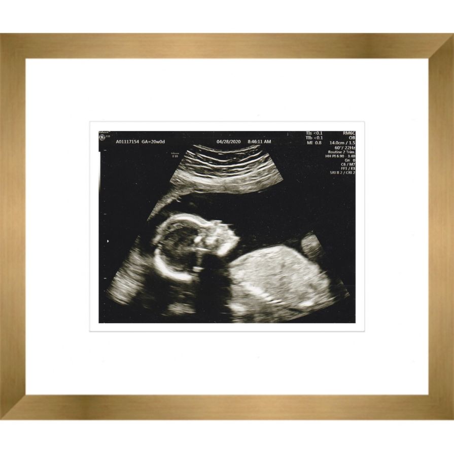 Gold Sonogram Frame with Double Mats