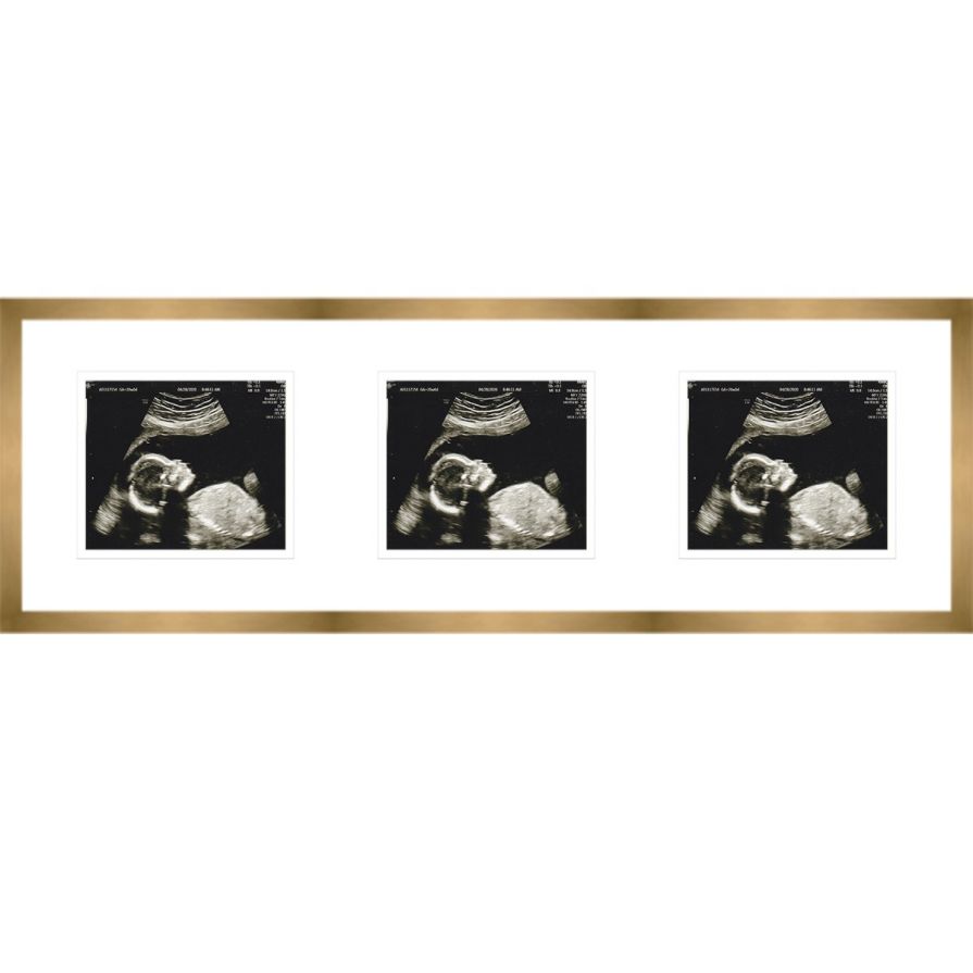 Gold Sonogram Frame with Double Mats for 3 Images